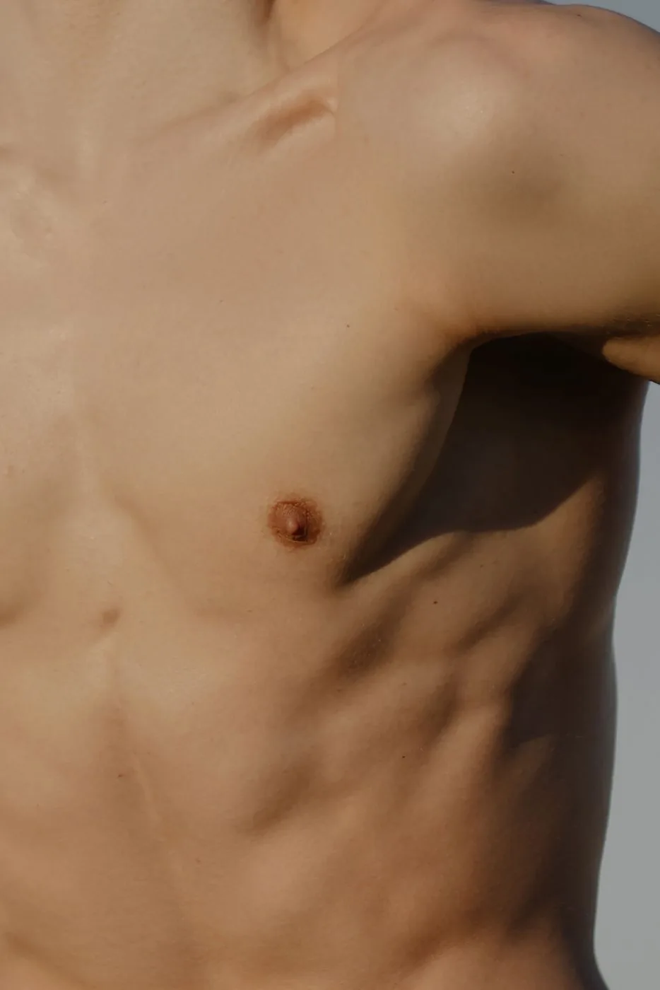 Definierte männliche Brust nach Gynäkomastie-Behandlung Düsseldorf